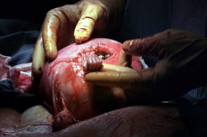 The Hand of Hope prints copy 2